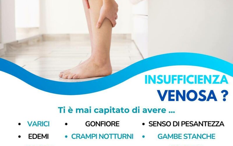 Insufficienza Venosa